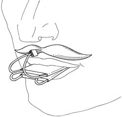 Увеличить: устройство для стрижки усов